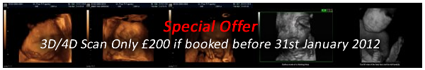 3D Ultrasound Northern Ireland